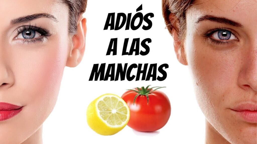 Remedios naturales efectivos para eliminar imperfecciones en el rostro ...